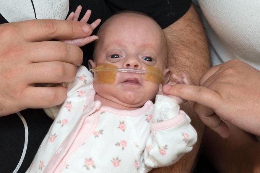 Csoda: túlélte a koraszülött baba, aki 14 centivel jött a világra