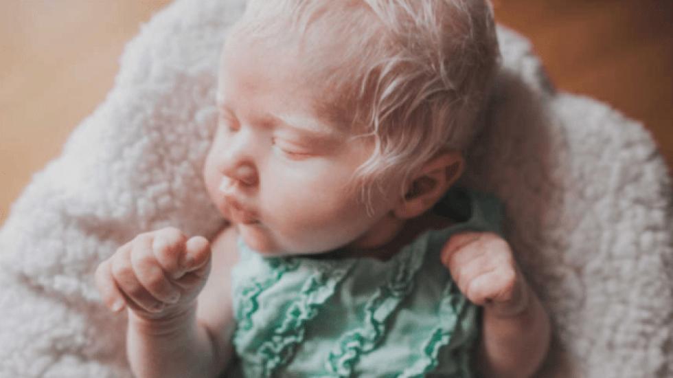5 éves kislány szívmelengető reakciója, mikor meglátta albínó kishúgát