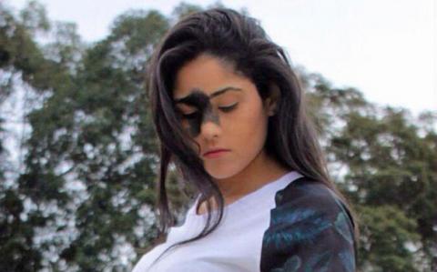 Modell lett a brazil lány, akinek óriási anyajegy borítja az arcát