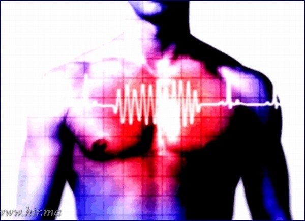Tízperces szűrővizsgálattal a hírtelen szívhalál megelőzéséért