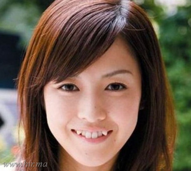 Japán nők valódi vámpír fogakat készíttetnek maguknak!