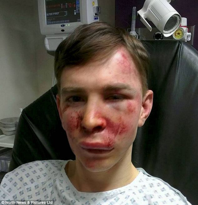 A fogyatékos fiúnak bakanccsal rugdosták meg az arcát