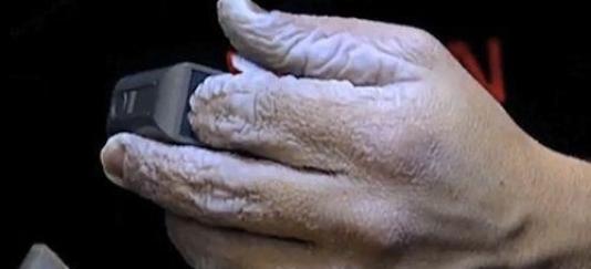 Ilyen az emberi kéz, ami 10 napig a víz alatt volt
