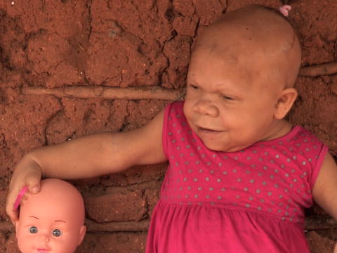 32 éves lány, aki megállt a növekedésben 9 hónapos korában! Videó
