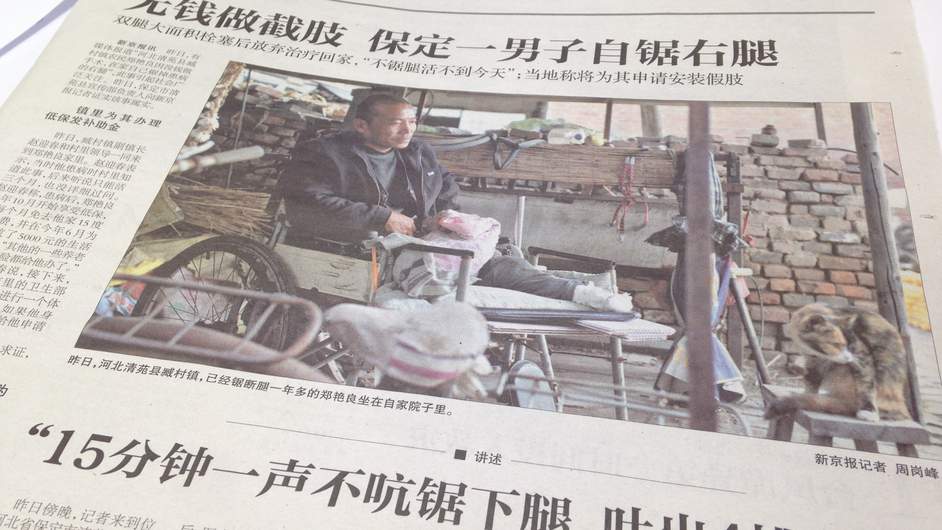 Kína: nem tudott a kórháznak fizetni, ezért saját maga amputálta a lábát – fotó