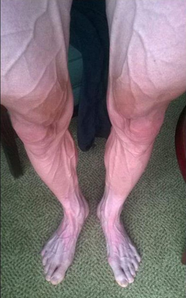 A lengyel Tour de France versenyző megdöbbentő képet posztolt lábáról
