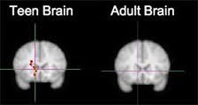 Ezért működik másképpen a tinik agya, mint a felnőtteké