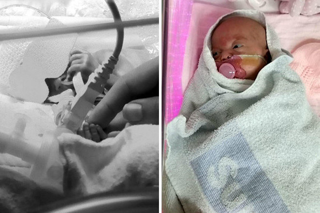 Meggyógyult a 24. hétre született baba, akit ötször hoztak vissza a halálból
