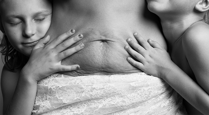 Kendőzetlen szülés utáni fotók mutatják meg a női testet