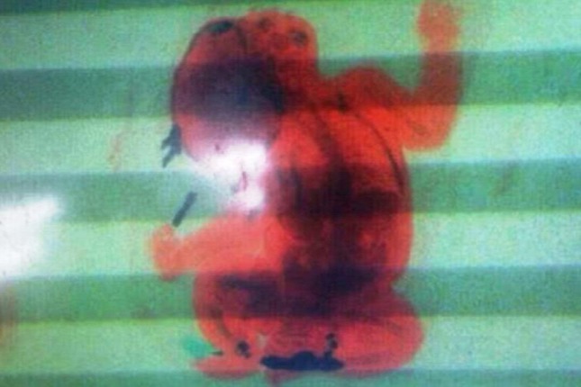 Ezt a 2 hónapos babát rejtette a reptéren átvilágított hátizsák – fotó
