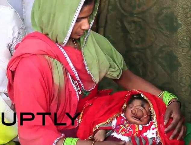Istennőként tisztelik a torz arcú indiai újszülöttet – megrázó képek 18+