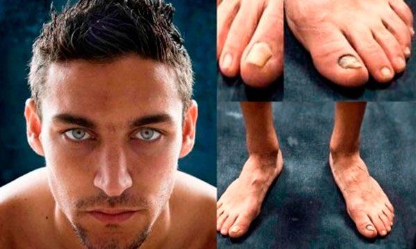 Bizarr fotók – így néz ki a sztárfocisták lábfeje