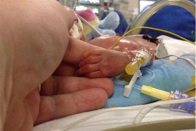 Megrázó! Elvesztette babáját, mert vesekőnek nézték az orvosok a vetélést