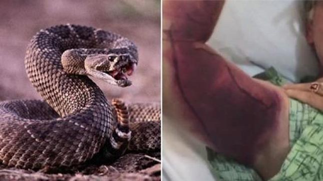 Így járt a férfi, aki közös szelfit akart egy csörgőkígyóval – videó