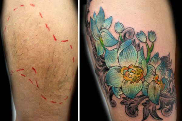 Ingyen tetoválással tünteti el a nőkről az erőszak nyomait egy művész – fotók 18+