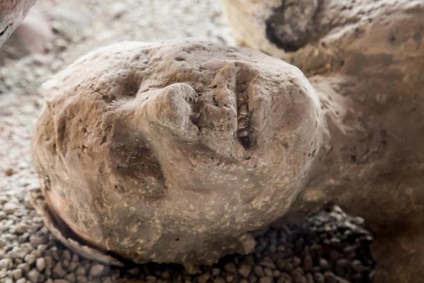 Megröntgenezték Pompeji megkövült lakóit: jól táplálkoztak, fogazatuk ép volt