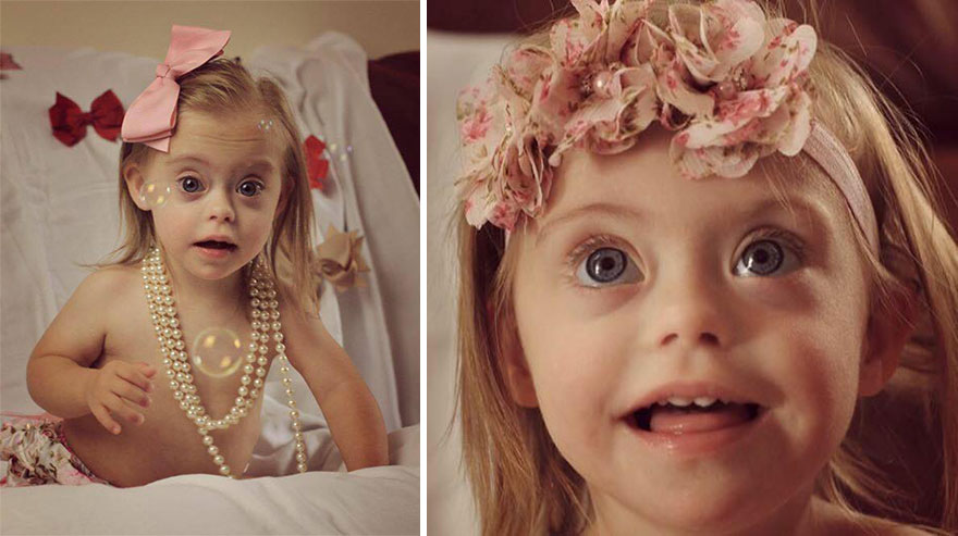 Modell lett a csodaszép 2 éves Down-szindrómás kislányból