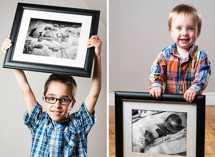 Erőteljes előtte és utána képek koraszülött babákról