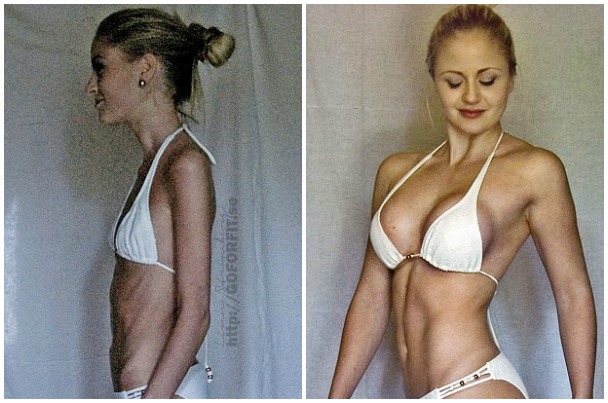 Súlyemelés gyógyította ki az anorexiájából a 38 kilóra fogyott lányt