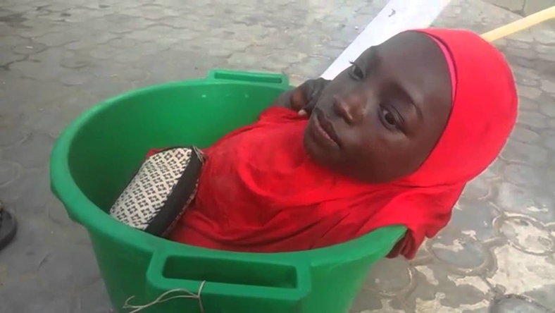 Lavórban él a nigériai lány, akinek csak a feje fejlődött ki rendesen – videó