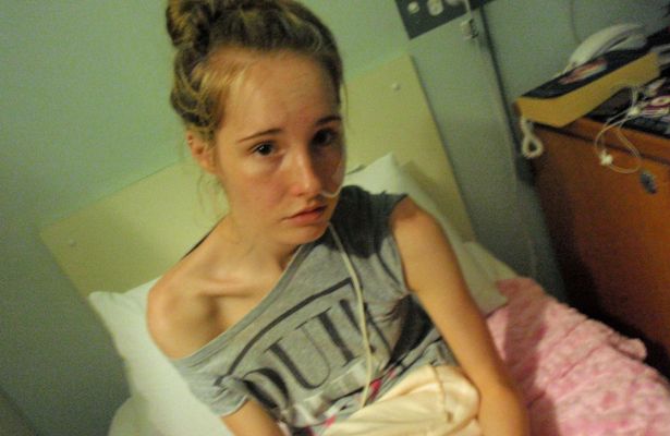 Sikerült legyőznie a súlyos anorexiát a 29 kilóra lefogyott lánynak - megrázó képek