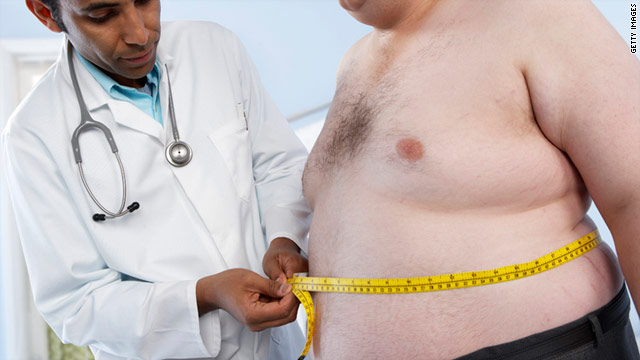 Szakértő: Magyarországon legnagyobb az elhízottak aránya Európában