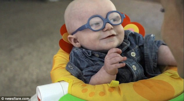 Először látja édesanyja arcát az albínó baba – megható videó