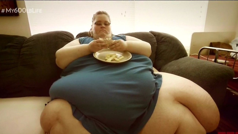 200 kilótól szabadult meg a világ legkövérebb nője! - megrázó képek