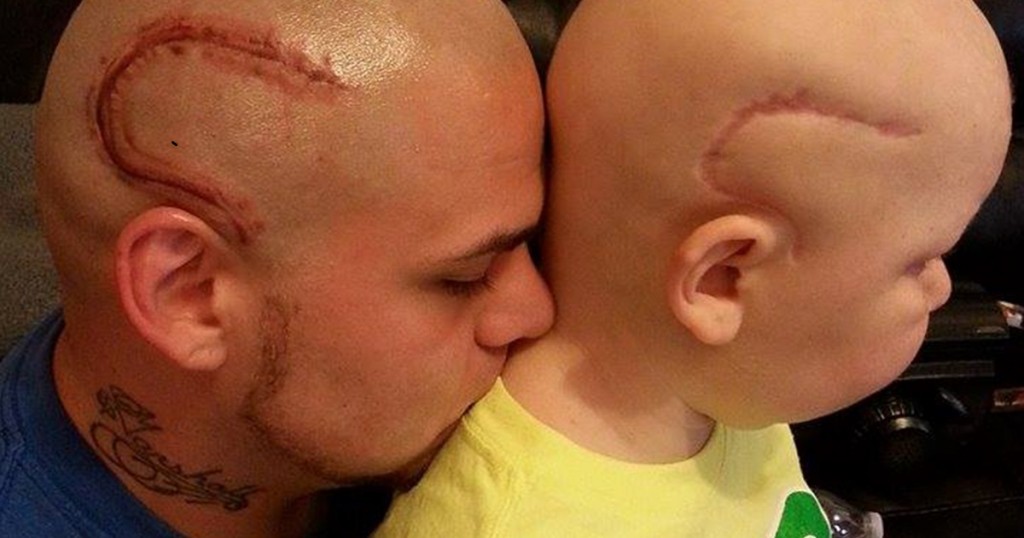 Kisfia műtéti hegét tetováltatta a fejére a fantasztikus apuka