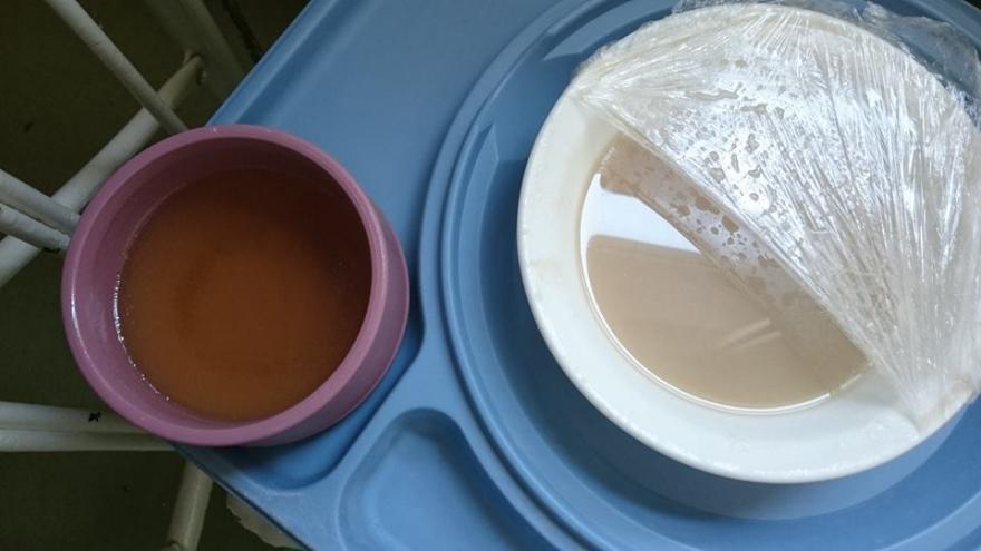 Undorító ebédet kapott az 1 éves gyerek az orosházi kórházban – fotó