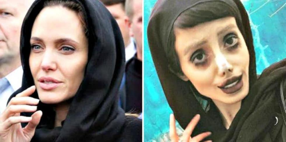 Hazudott az Angelina Jolie-vá plasztikázott lány