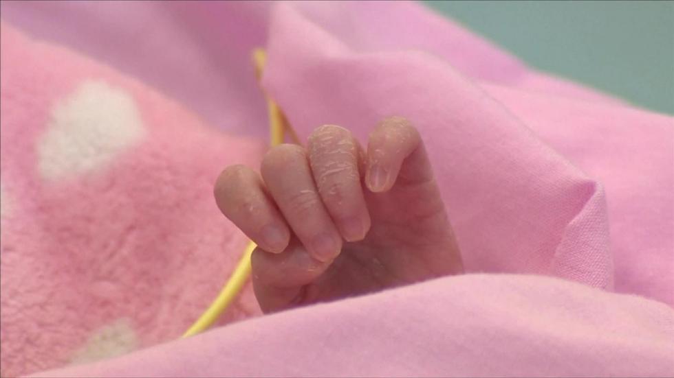 Túlélte a brit baba, aki testén kívül dobogó szívvel született -videó 18+