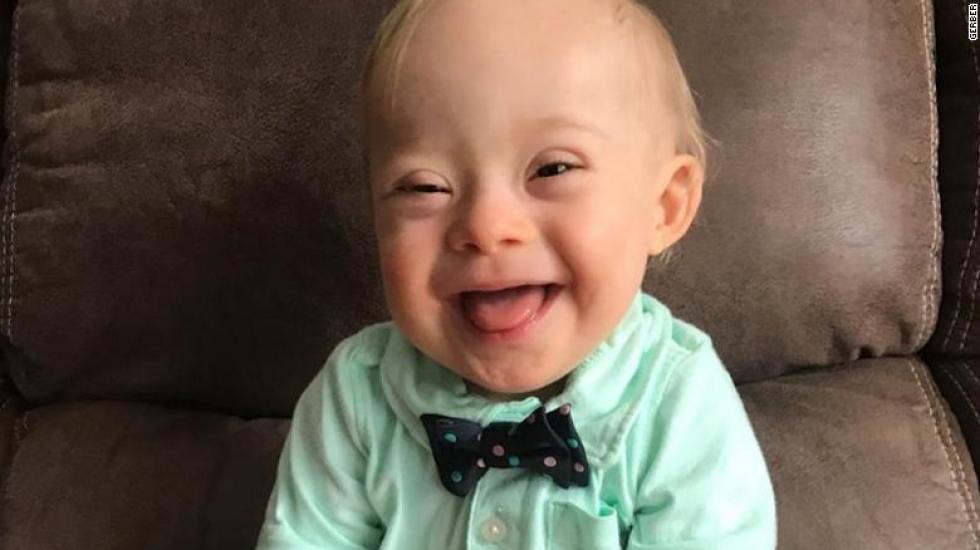 Down-szindrómás, 18 hónapos kisfiú lett az ismert márka arca