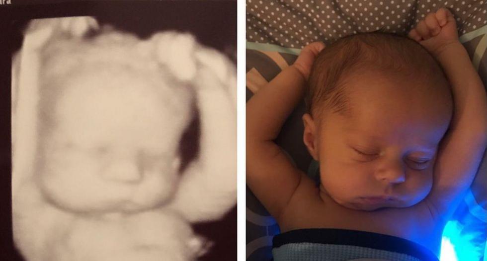 Édes fotó: ugyanabban a pózban alszik a baba, mint az anyaméhben
