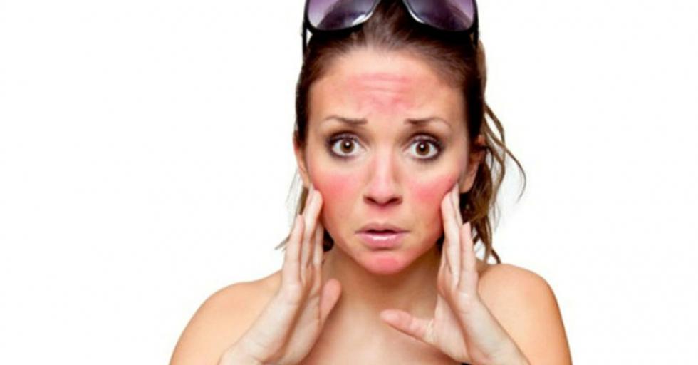 Top 5 legfurcsább allergia, amikről talán még nem is hallottál