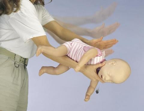 Mindenkinek tudnia kell, akinek gyermeke van- ezt kell tenned légúti elzáródás esetén