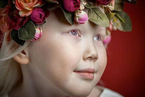 Tündérszép albínó kislányért rajonganak a modellügynökségek
