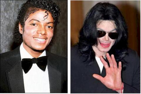 Michael Jackson fehér akart lenni?