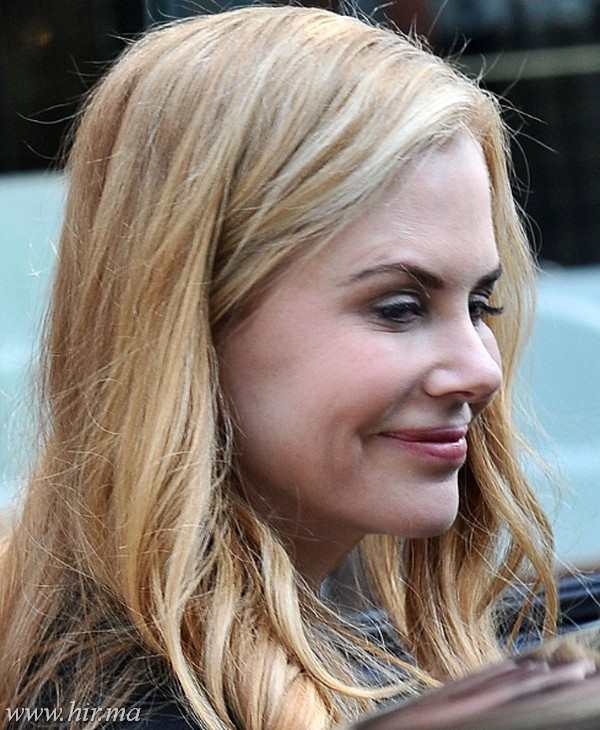 Nicole Kidman ismét botoxoltatott?