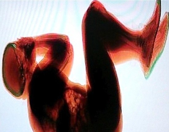 Reptéri futószalagon utazott a részeg - most röntgensugárzás miatt a kórházban van