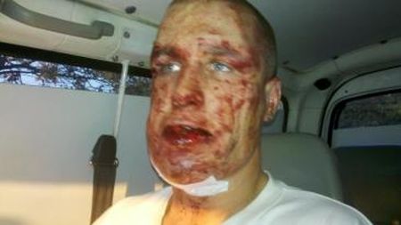 Roma támadók nyakon szúrtak egy magyart - a rendőrség az áldozatnál házkutatott...