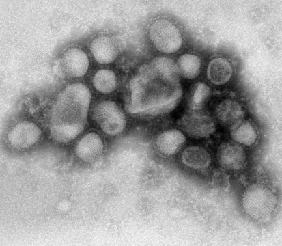 Már két sertésinfluenzás ember van kórházban Pozsonyban