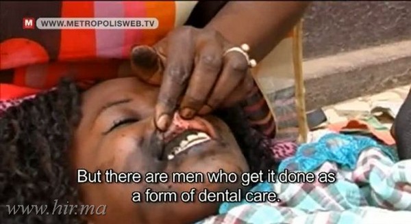 Szenegáli nők az ínyüket feketére tetováltatják a tökéletes mosolyért! Videó