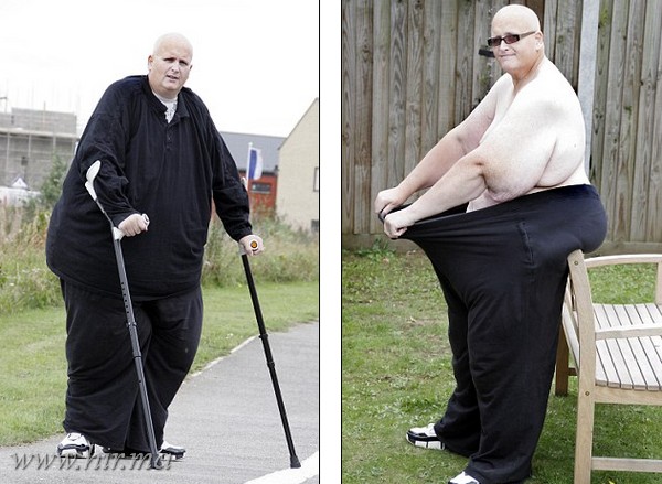 286 kg- t fogyott a világ legkövérebb embere