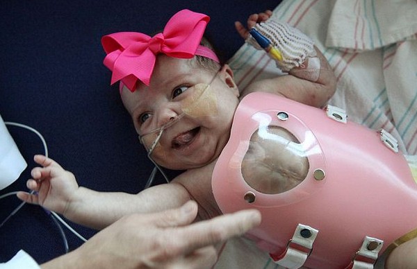 Egy újszülött kislány szívét egy rózsaszín pajzs tart a helyén