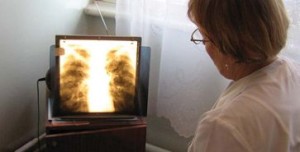 t&eacute;b&eacute;c&eacute;s