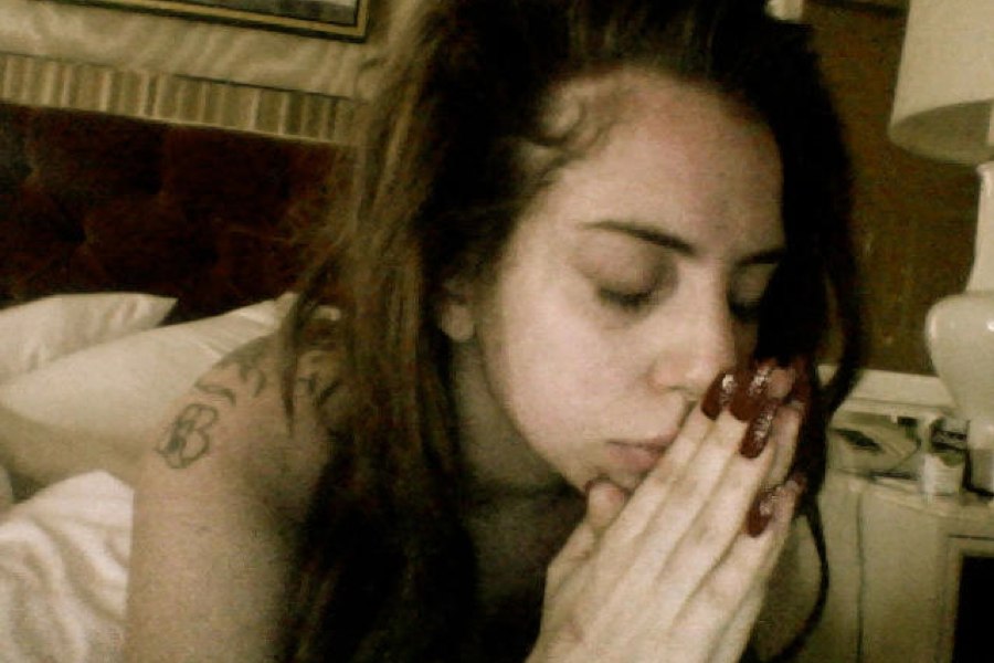 Lady Gaga csípőműtét után