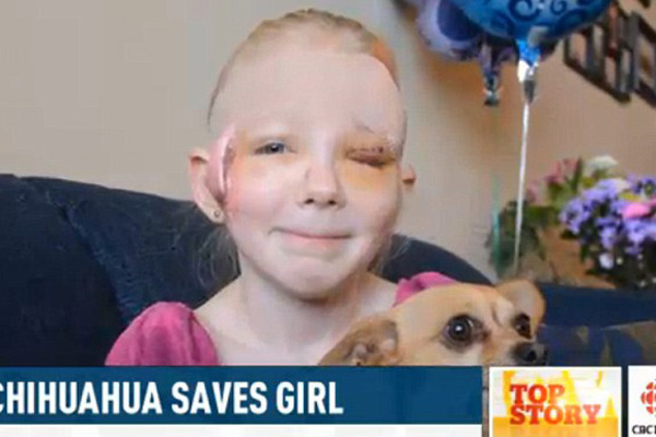 A csivava megmentette 8 éves gazdáját egy feldühödött pitbull támadásától
