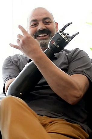 Bionic man keze tele van élettel