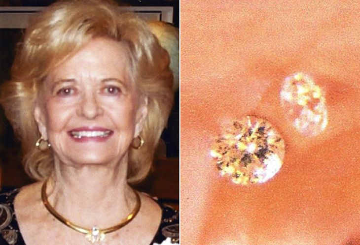 5000 dollár értékű gyémántot nyelt le a pezsgőjével